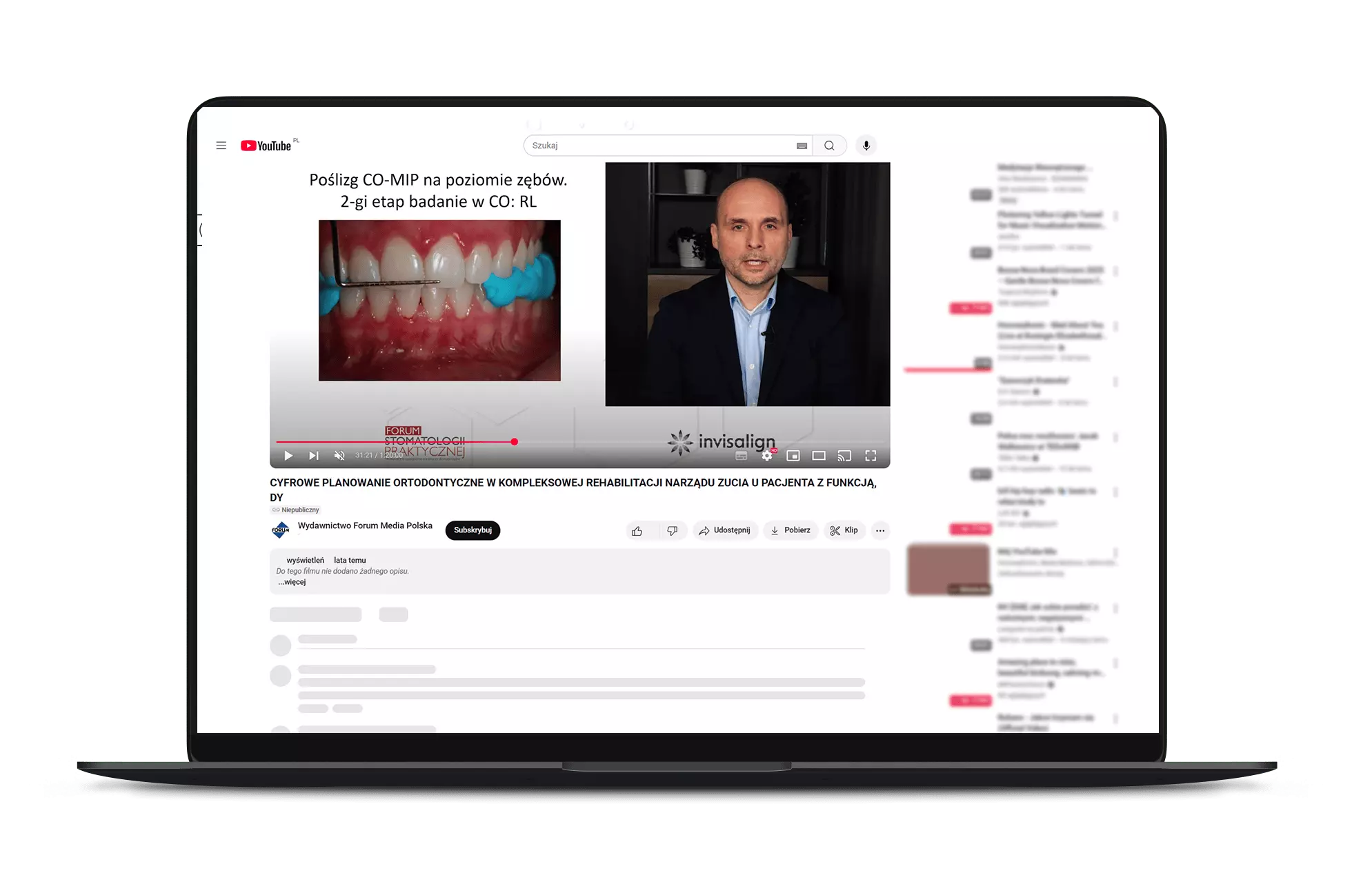 Webinary stomatologiczne